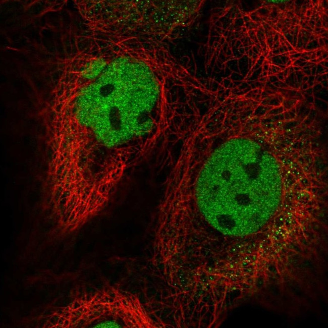 FIP1L1 Antibody in Immunocytochemistry (ICC/IF)