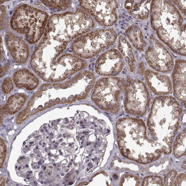 IMMP1L Antibody in Immunohistochemistry (Paraffin) (IHC (P))