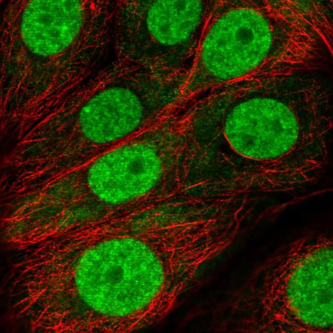 FUBP3 Antibody in Immunocytochemistry (ICC/IF)