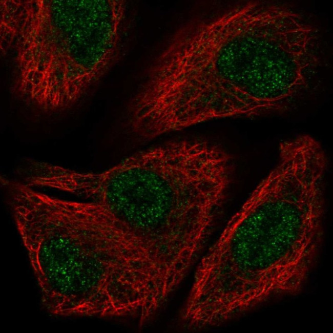 TOX2 Antibody in Immunocytochemistry (ICC/IF)
