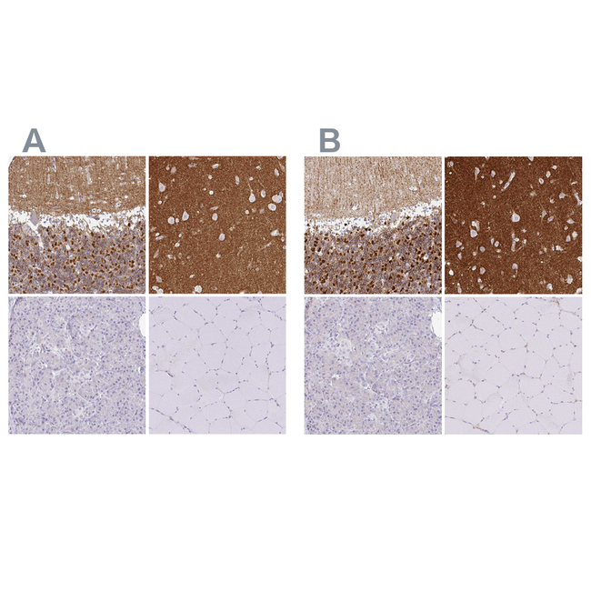 SIRP alpha Antibody in Immunohistochemistry (Paraffin) (IHC (P))