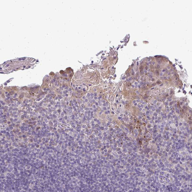 CMPK1 Antibody in Immunohistochemistry (Paraffin) (IHC (P))