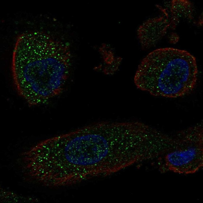 KRT25 Antibody in Immunocytochemistry (ICC/IF)