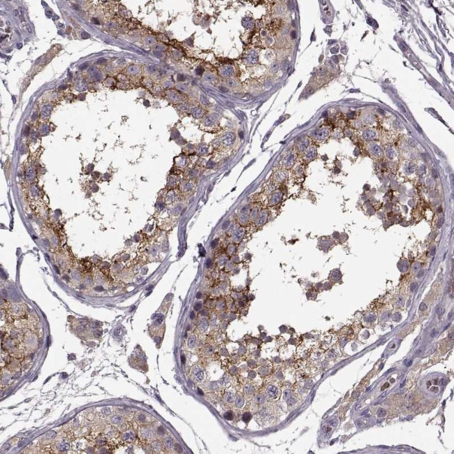 SLC52A3 Antibody in Immunohistochemistry (Paraffin) (IHC (P))
