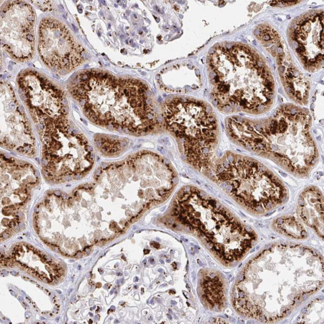 TM9SF1 Antibody in Immunohistochemistry (Paraffin) (IHC (P))
