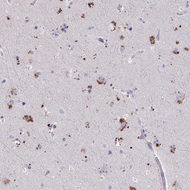 WDR97 Antibody in Immunohistochemistry (Paraffin) (IHC (P))