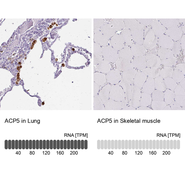 Tartrate Resistant Acid Phosphatase Antibody in Immunohistochemistry (Paraffin) (IHC (P))