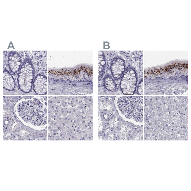 RNase12 Antibody in Immunohistochemistry (Paraffin) (IHC (P))
