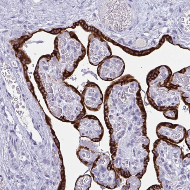 PRDM9 Antibody in Immunohistochemistry (Paraffin) (IHC (P))