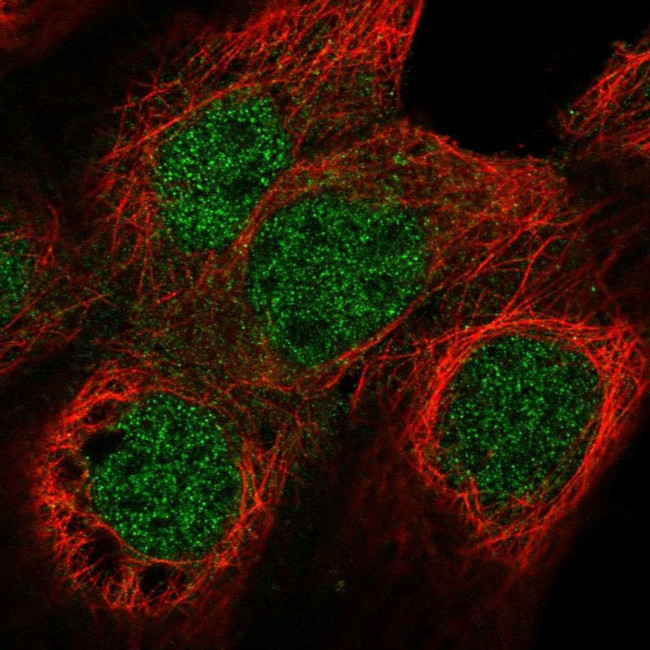 NUF2 Antibody in Immunocytochemistry (ICC/IF)