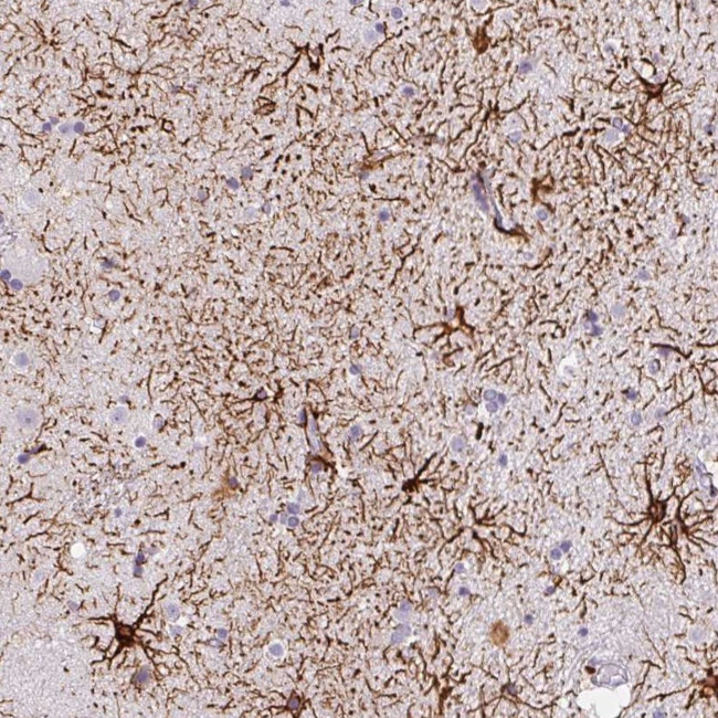 ECM29 Antibody in Immunohistochemistry (Paraffin) (IHC (P))