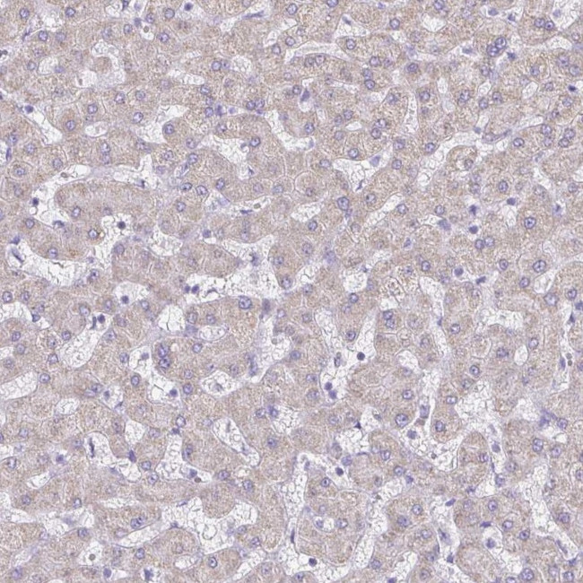 PGAM2 Antibody in Immunohistochemistry (Paraffin) (IHC (P))