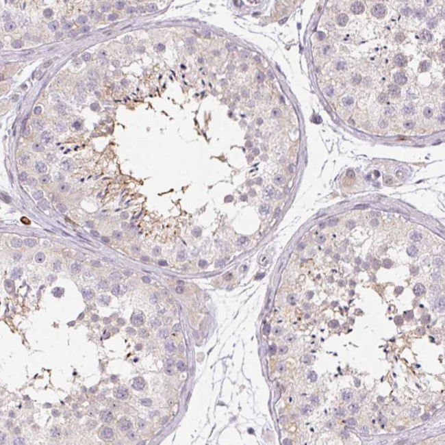 RPGRIP1 Antibody in Immunohistochemistry (Paraffin) (IHC (P))