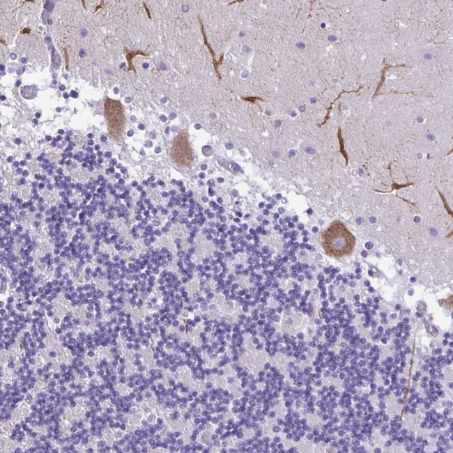 PAK3 Antibody in Immunohistochemistry (Paraffin) (IHC (P))