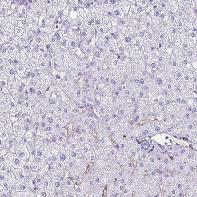 TPSG1 Antibody in Immunohistochemistry (Paraffin) (IHC (P))
