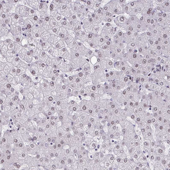 MTGR1 Antibody in Immunohistochemistry (Paraffin) (IHC (P))