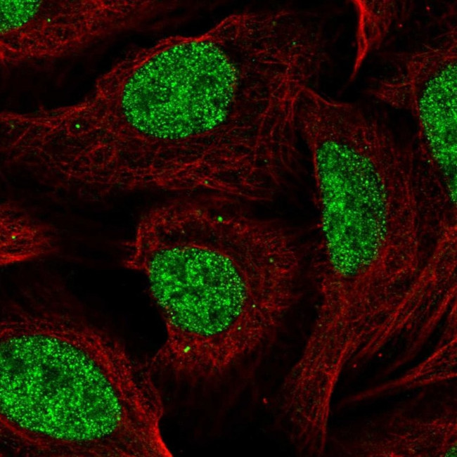 CCDC12 Antibody in Immunocytochemistry (ICC/IF)