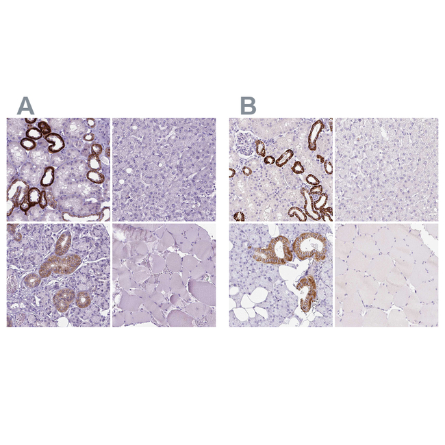BSND Antibody in Immunohistochemistry (Paraffin) (IHC (P))