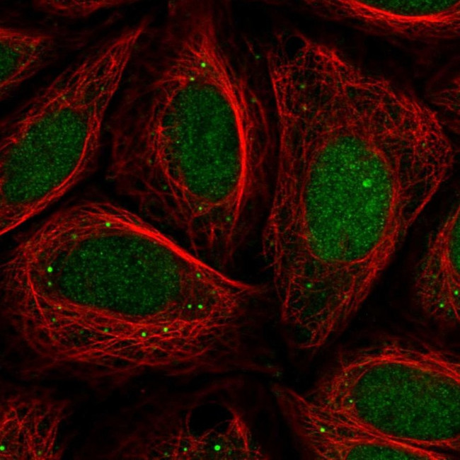 CHD2 Antibody in Immunocytochemistry (ICC/IF)