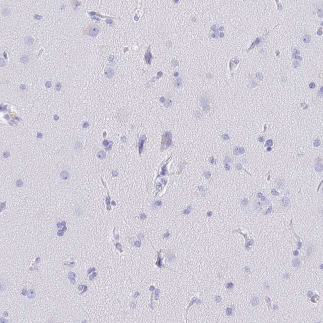 CD5 Antibody in Immunohistochemistry (Paraffin) (IHC (P))