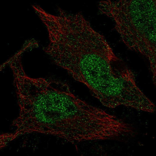 TLX3 Antibody in Immunocytochemistry (ICC/IF)
