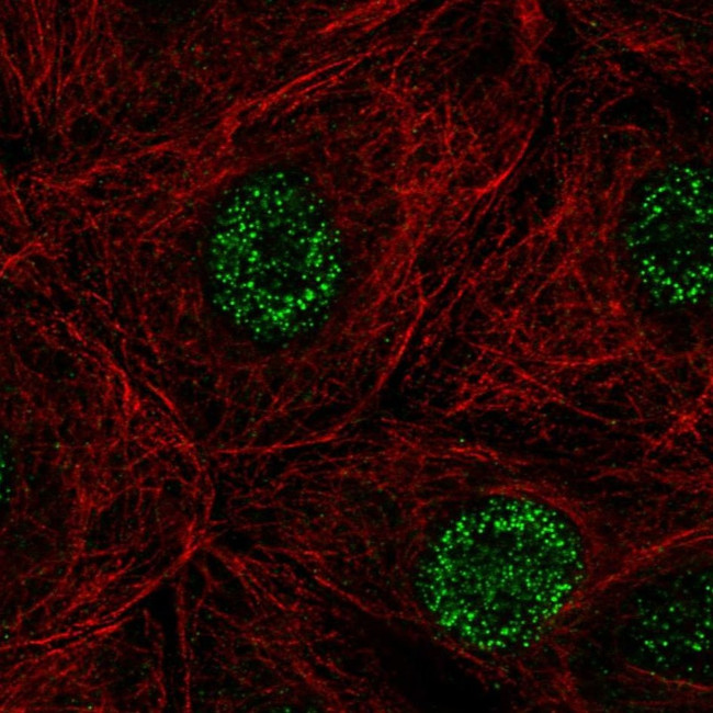 DCAKD Antibody in Immunocytochemistry (ICC/IF)