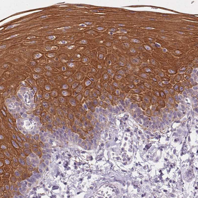 Cytokeratin 6A Antibody in Immunohistochemistry (Paraffin) (IHC (P))