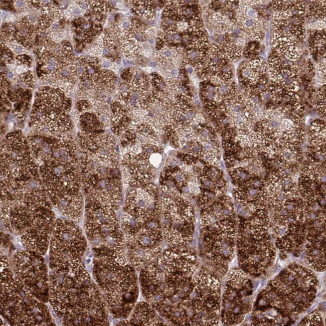 LIMS1 Antibody in Immunohistochemistry (Paraffin) (IHC (P))