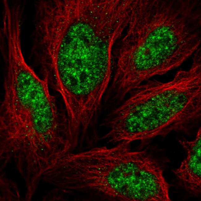 ALY Antibody in Immunocytochemistry (ICC/IF)