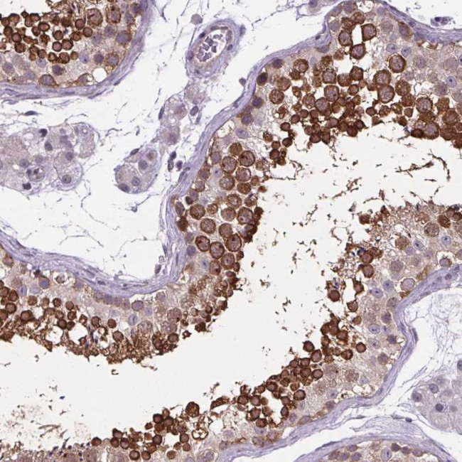 TTC12 Antibody in Immunohistochemistry (Paraffin) (IHC (P))