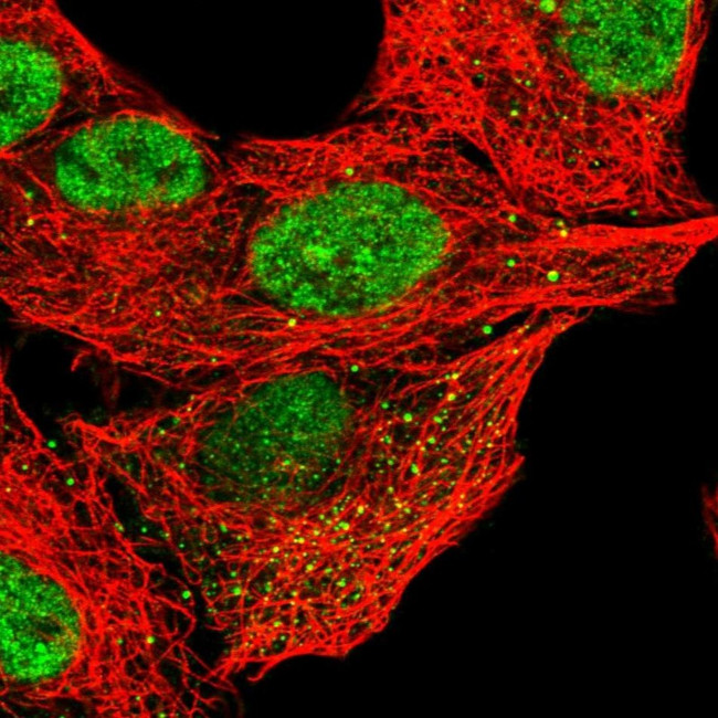 CLEC16A Antibody in Immunocytochemistry (ICC/IF)