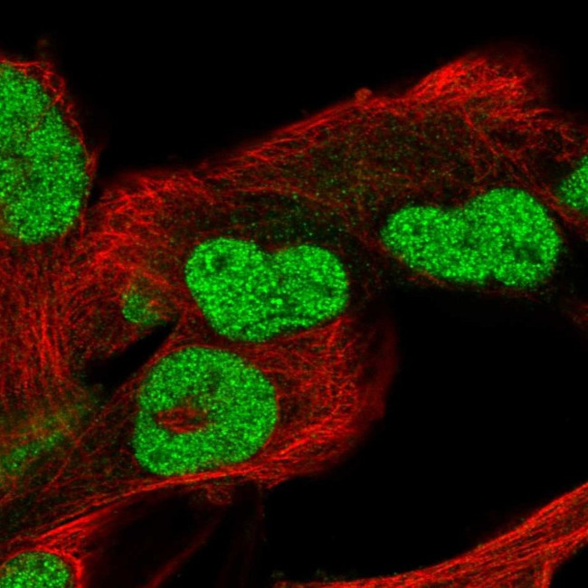 POC5 Antibody in Immunocytochemistry (ICC/IF)