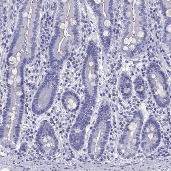 CYB5R2 Antibody in Immunohistochemistry (Paraffin) (IHC (P))
