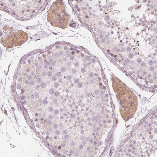 BRSK1 Antibody in Immunohistochemistry (Paraffin) (IHC (P))