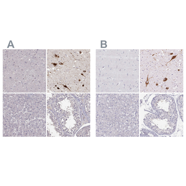 PMCH Antibody in Immunohistochemistry (Paraffin) (IHC (P))