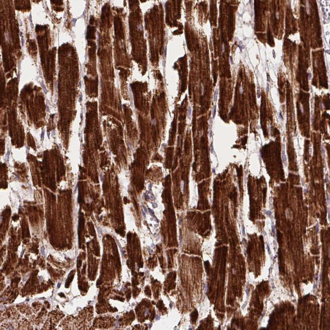 NDUFS2 Antibody in Immunohistochemistry (Paraffin) (IHC (P))