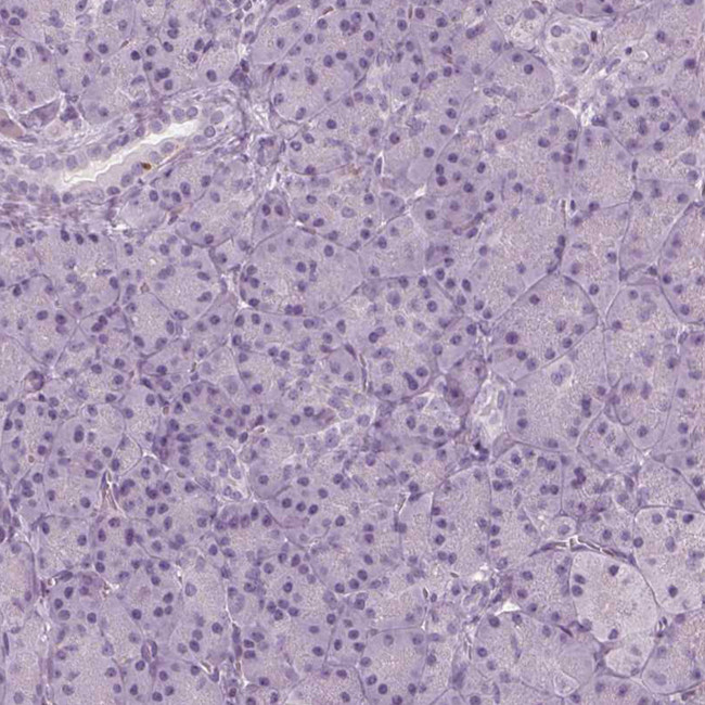 BTLA Antibody in Immunohistochemistry (Paraffin) (IHC (P))