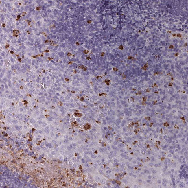 Kallikrein 7 Antibody in Immunohistochemistry (Paraffin) (IHC (P))