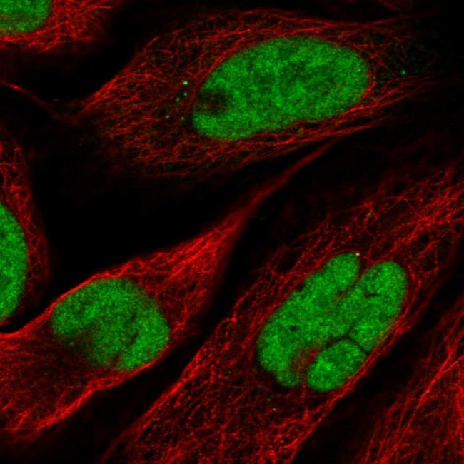 NOSIP Antibody in Immunocytochemistry (ICC/IF)