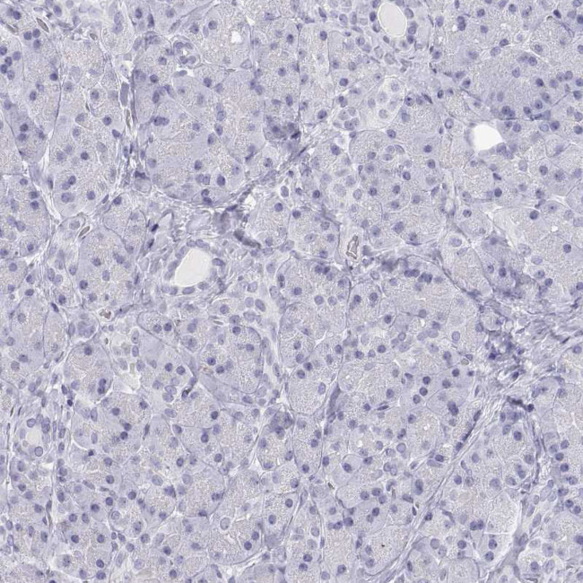 SFTPB Antibody in Immunohistochemistry (Paraffin) (IHC (P))