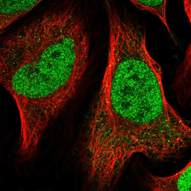 NAC1 Antibody in Immunocytochemistry (ICC/IF)