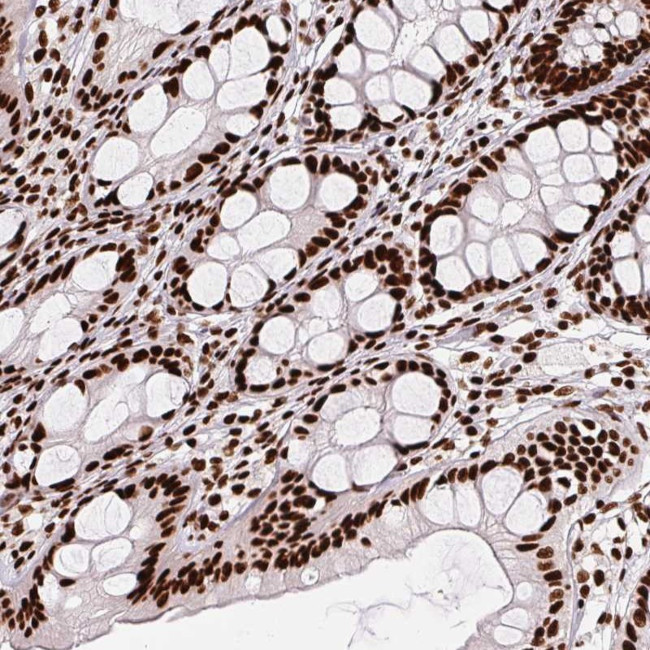 PAGE3 Antibody in Immunohistochemistry (Paraffin) (IHC (P))