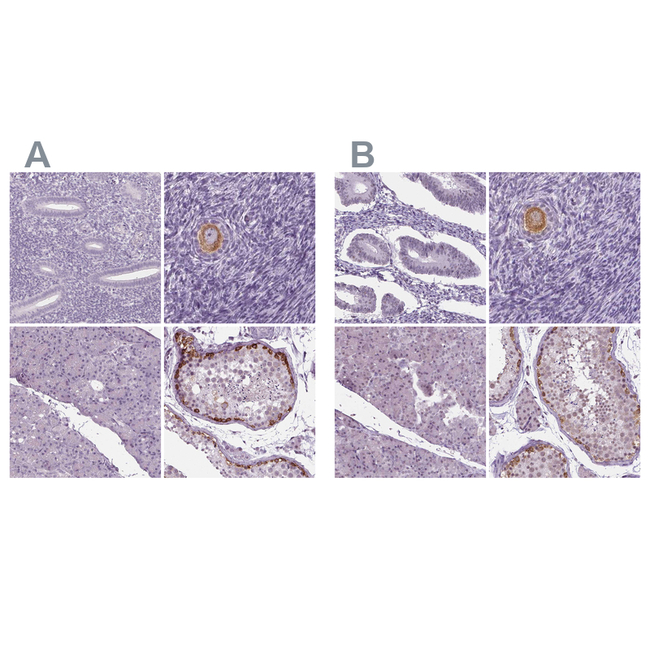 IGF2BP1 Antibody in Immunohistochemistry (Paraffin) (IHC (P))