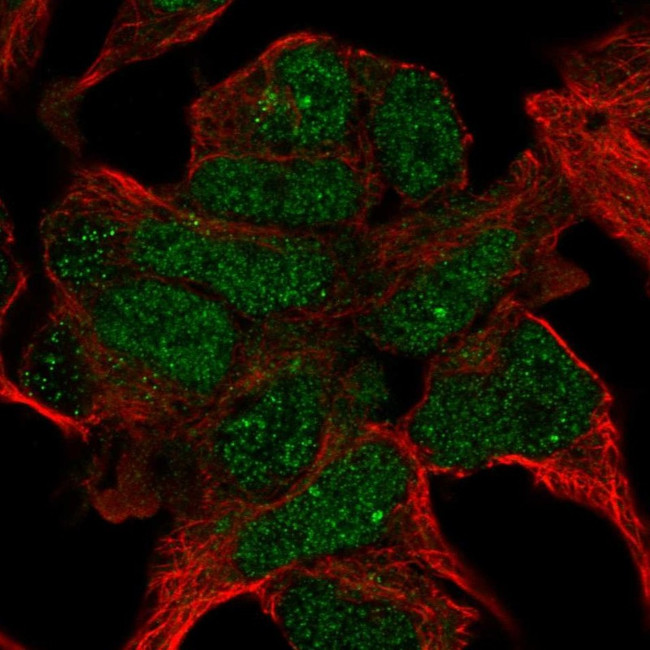 Prosapip2 Antibody in Immunocytochemistry (ICC/IF)