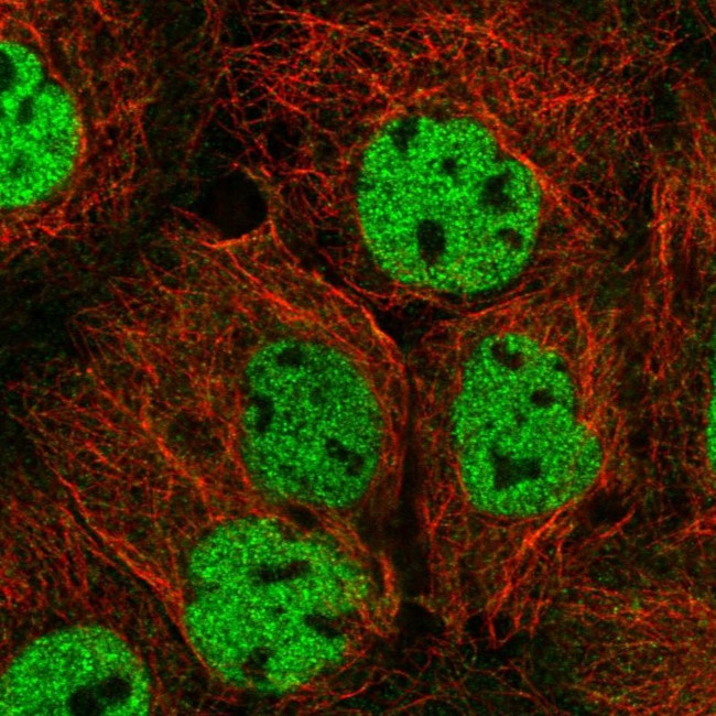 ORAOV1 Antibody in Immunocytochemistry (ICC/IF)