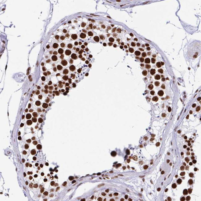 EWSR1 Antibody in Immunohistochemistry (Paraffin) (IHC (P))
