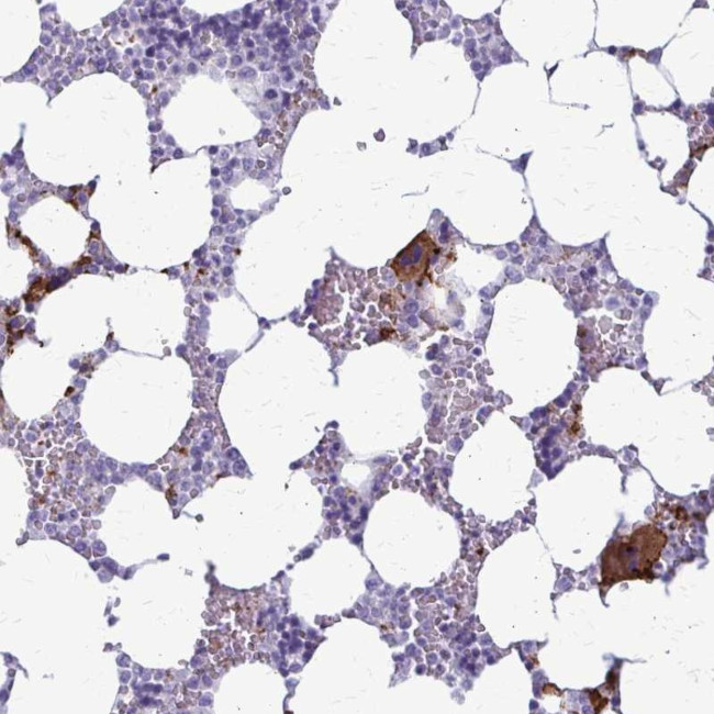 CD42a Antibody in Immunohistochemistry (Paraffin) (IHC (P))