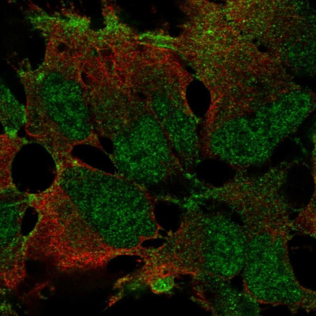 ZNF560 Antibody in Immunocytochemistry (ICC/IF)