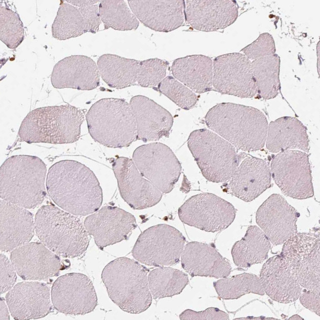IL9R Antibody in Immunohistochemistry (Paraffin) (IHC (P))
