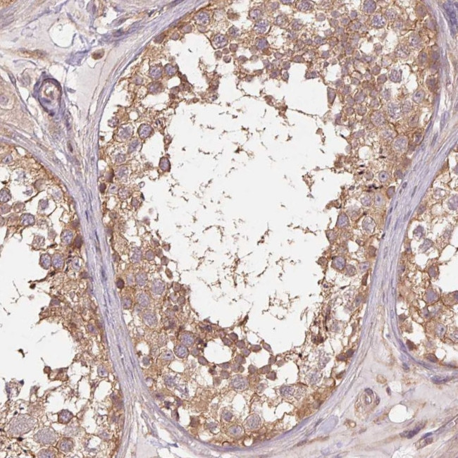 Tubulin alpha-1B Antibody in Immunohistochemistry (Paraffin) (IHC (P))